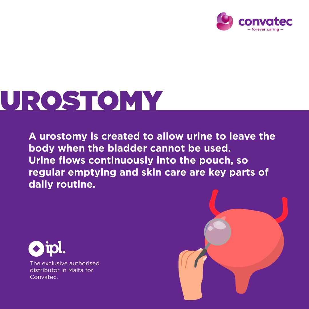 Stoma Inversion What is a stoma? - Ian Pace Ltd
